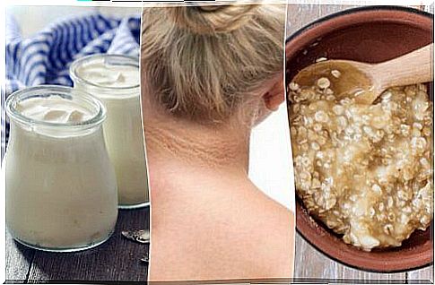 Fight dark spots on your neck with 5 natural remedies