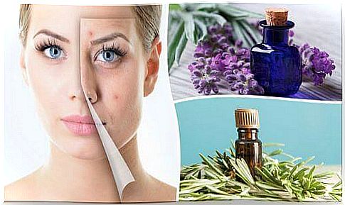 How to remove acne with essential oils