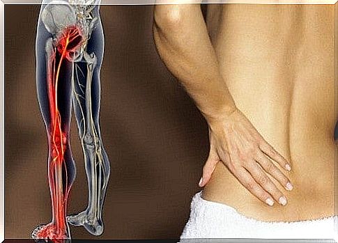 How to treat sciatica with infusions and natural remedies