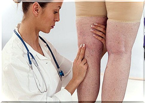 Doctor marks after fluid retention