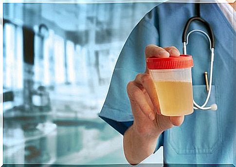 Doctor with urine sample