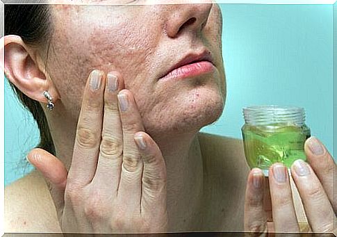 Woman applying aloe vera on her face