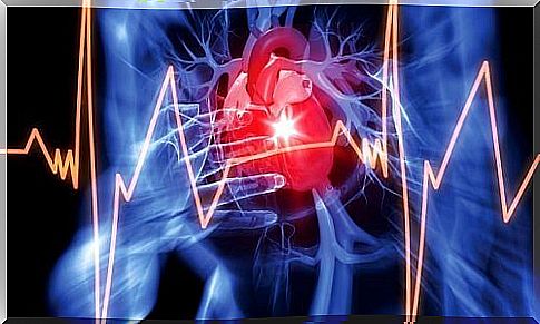 Heart illustrates too much fluid in the pericardium