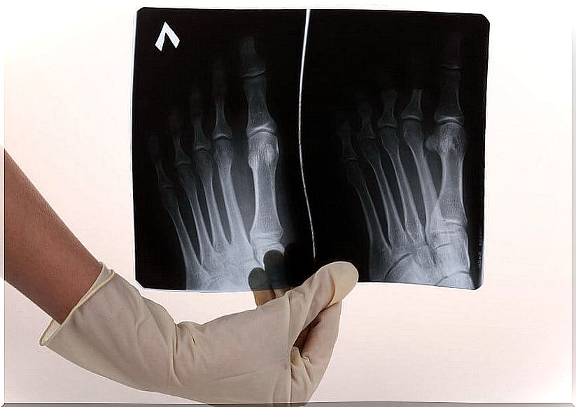 X-ray pictures