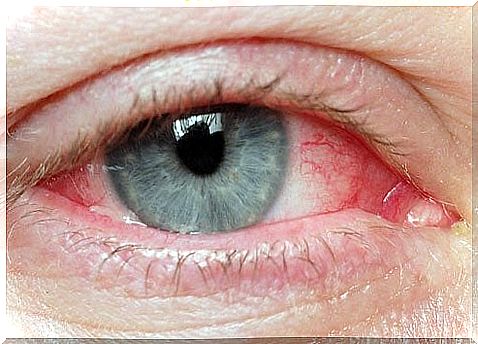 Try these natural ways to relieve irritated eyes