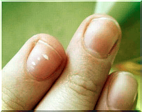 fingernails