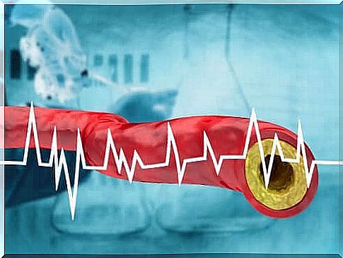 You can keep high cholesterol levels away through your diet